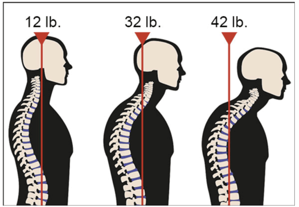 Best Neck Pain Solutions - Text Neck Posture Secrets - Home Fitness ...